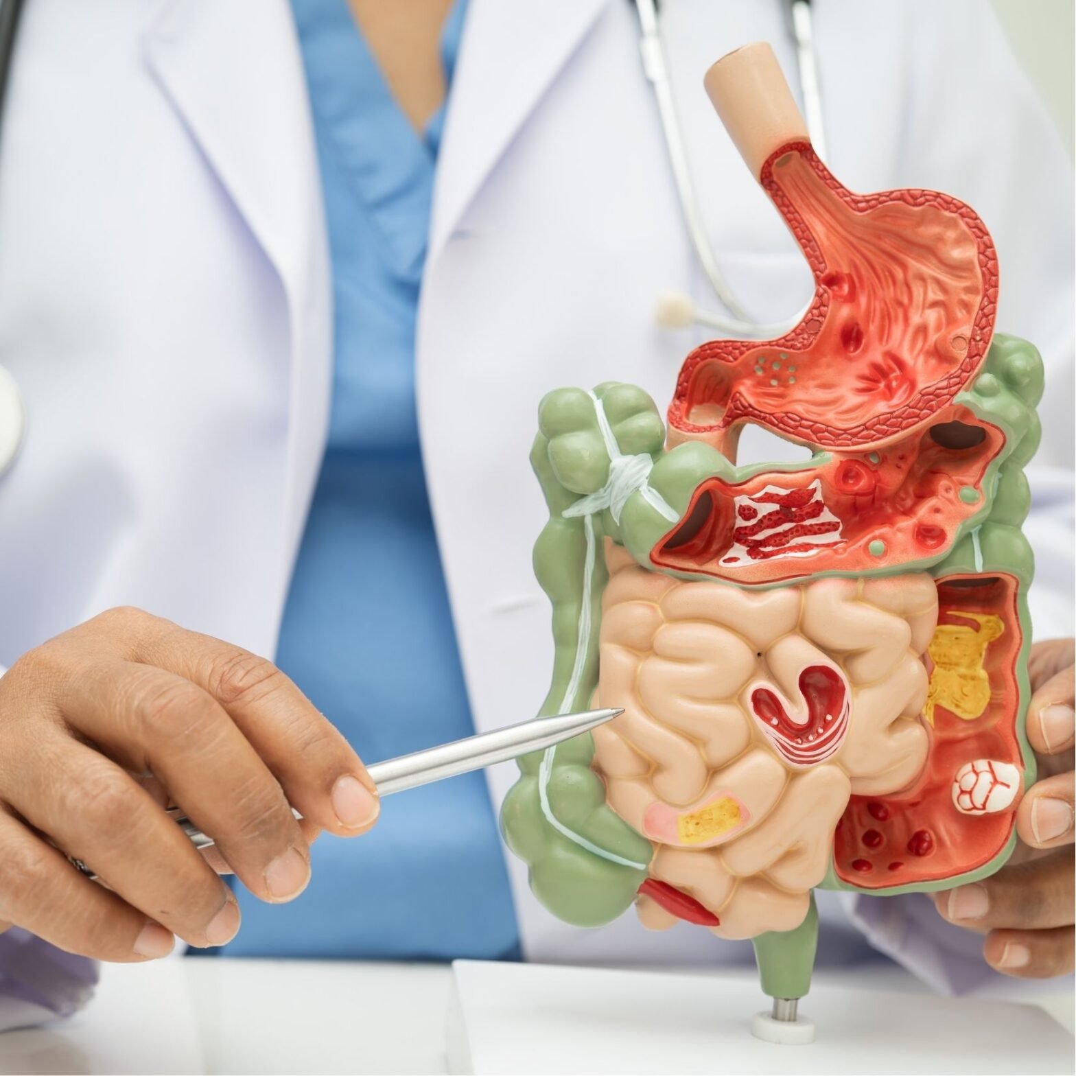 Best Gastroenterology Treatment in Nairobi