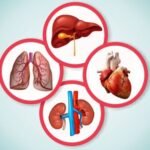 best Organ Transplant in Nairobi
