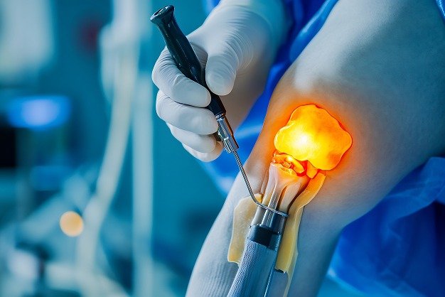 Knee Pain Treatment in Nairobi