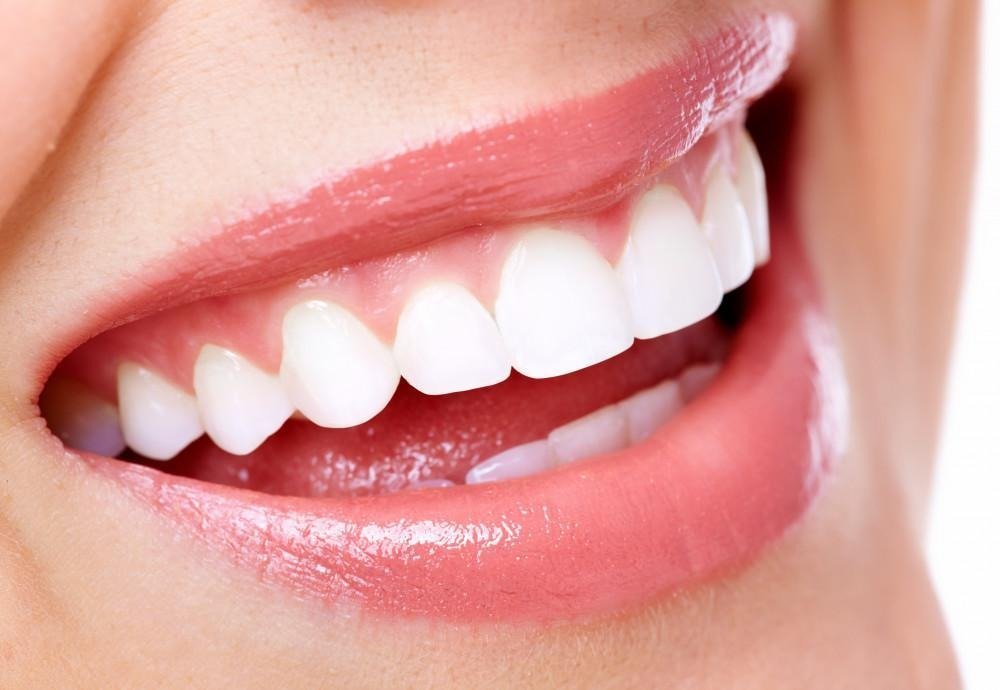 Dental Implants in Nairobi